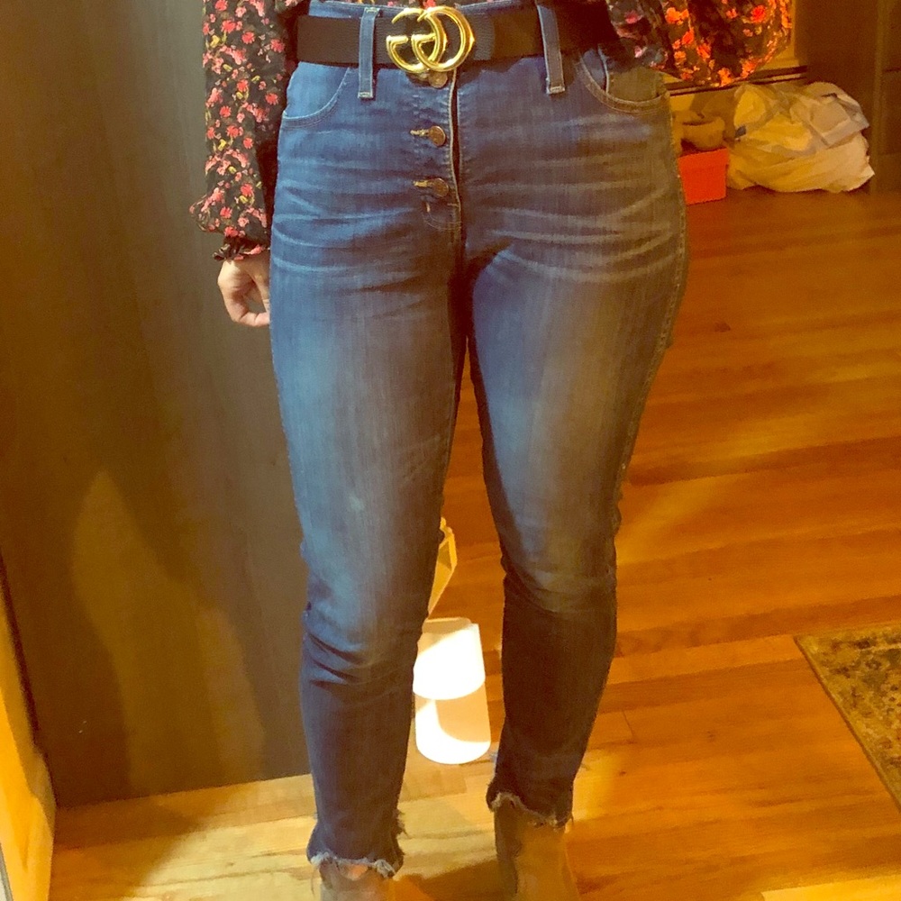 Madewell Button-Fly High-Waisted Skinny Jeans